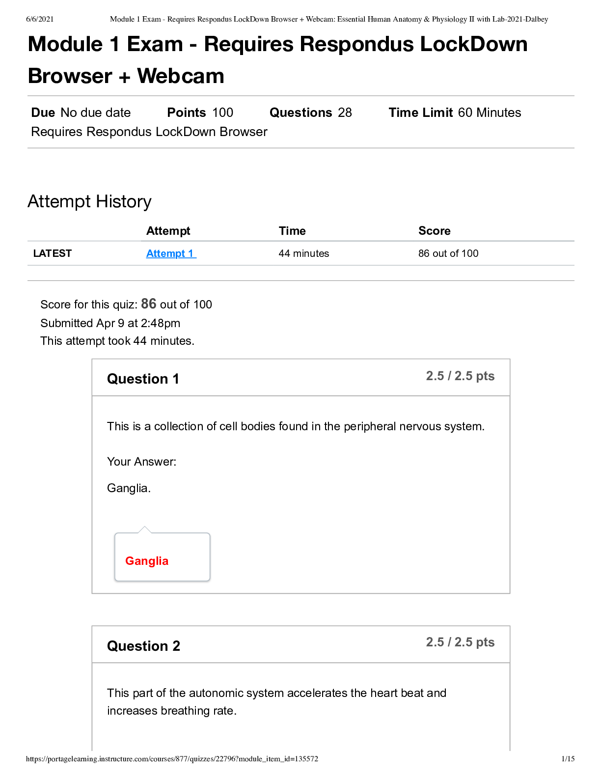 Essential Human Anatomy & Physiology II with Lab-2021-Dalbey Module 1 Exam - Requires Respondus