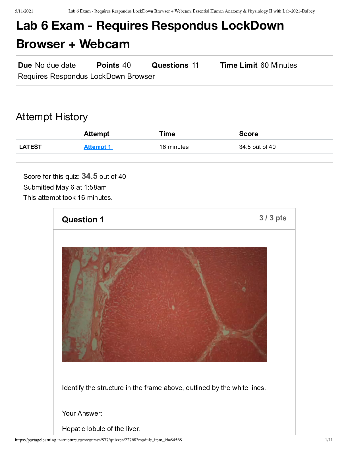 Human Anatomy & Physiology II Lab Exam – Dalbey 2021 | LockDown Browser Required